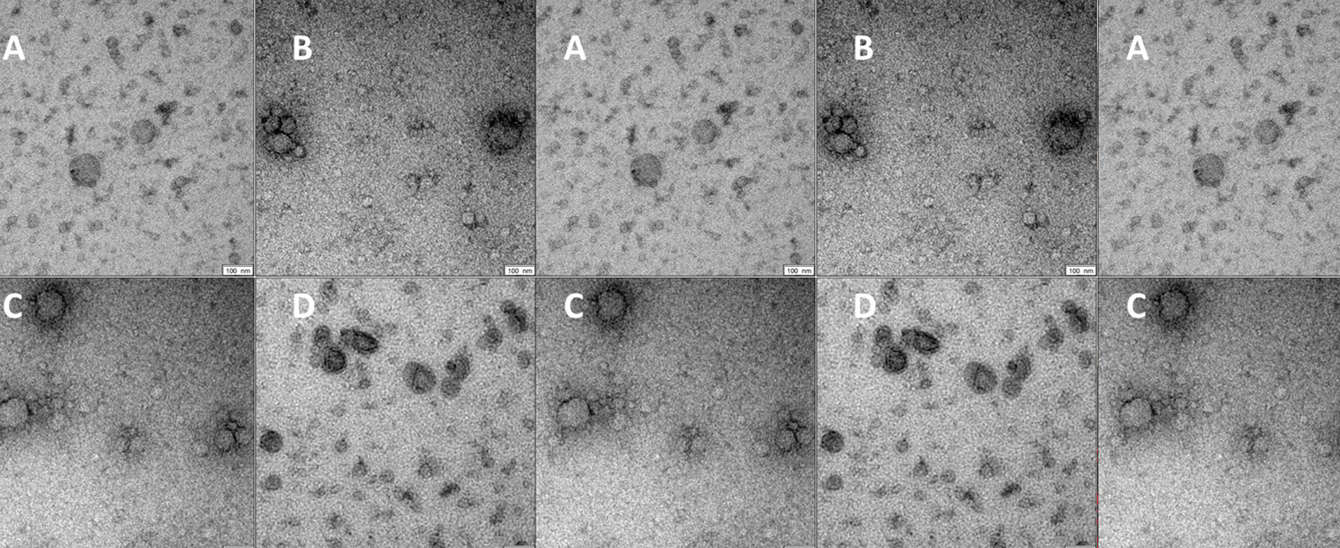 Extrazelluläre Vesikel zur Diagnose von COVID-19 R3