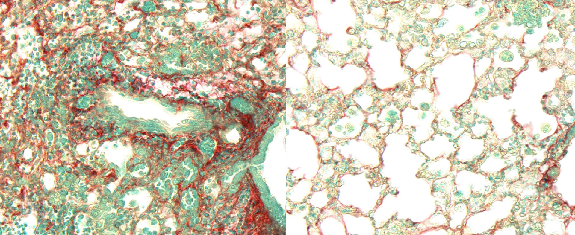 Die Inhalation von RCS-21 verhindert die Bleomycin-induzierte Lungenfibrose bei Mäusen. Der Maßstabsbalken zeigt 100 μm. (Quelle: Technische Universität München, Institut für Pharmakologie und Toxikologie)