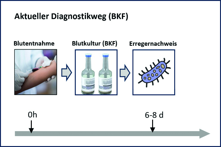 Gängige Erregerdiagnostik in der Klinik mit Blutkulturflaschen (Quelle: Technische Universität München Klinikum rechts der Isar, Klinik für Orthopädie und Sportorthopädie)