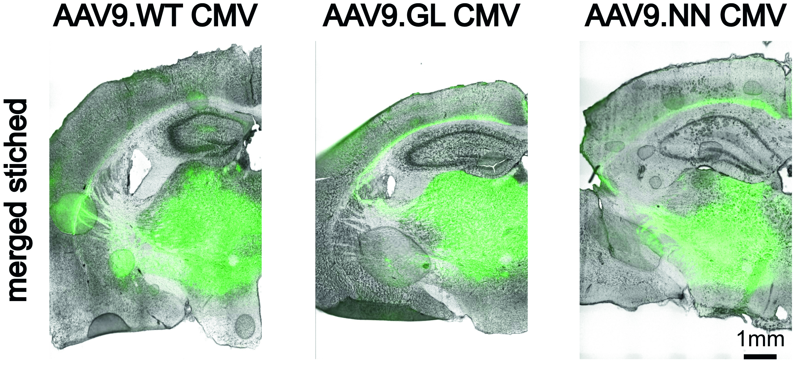 Enhanced-green-fluorescent-protein-Expression in thalamokortikalen Neuronen nach stereotaktischer rAAV9-Injektion bei sechs bis acht Wochen alten Mäusen. (Quelle: Dr. Verena Mehlfeld)